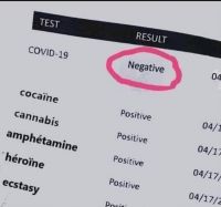 test_covid_negatif.jpg